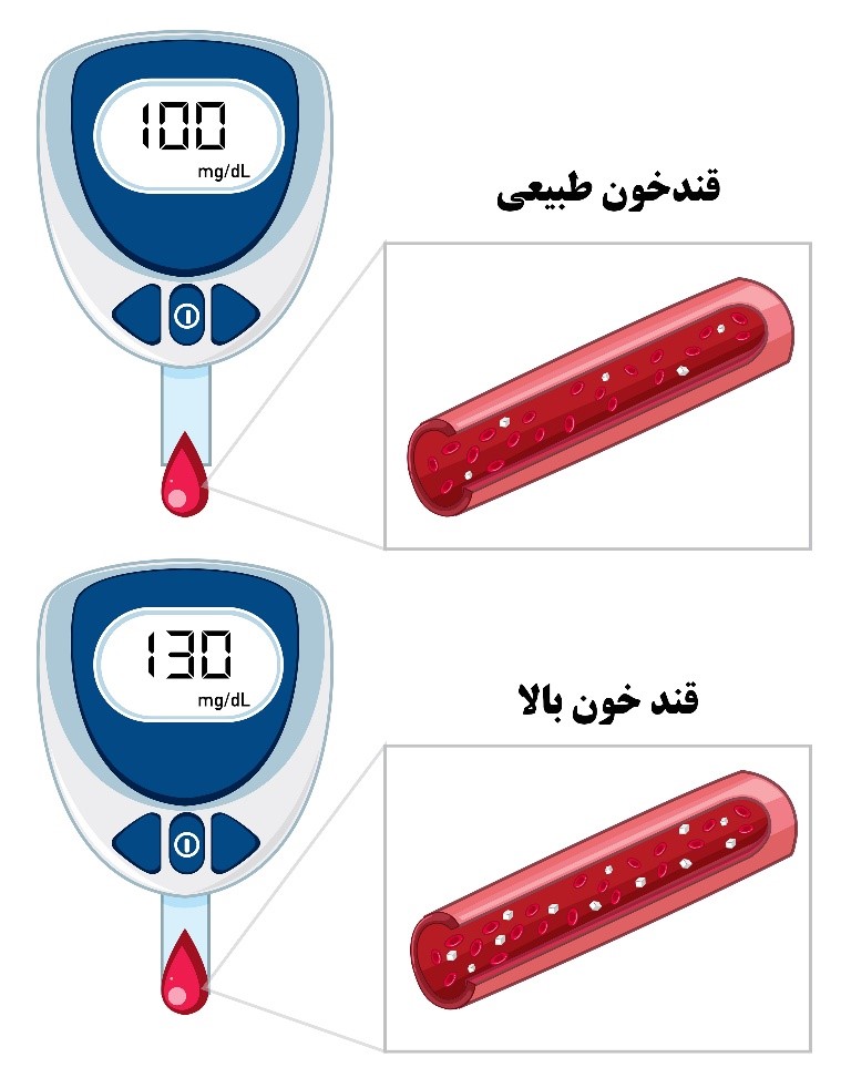 میزان قند خون طبیعی و بالا